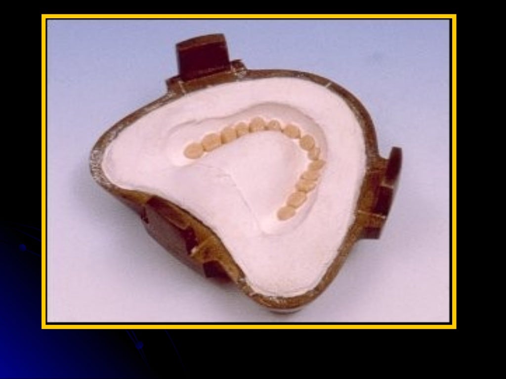 03 01 01_45(flasking and processing complete denture)