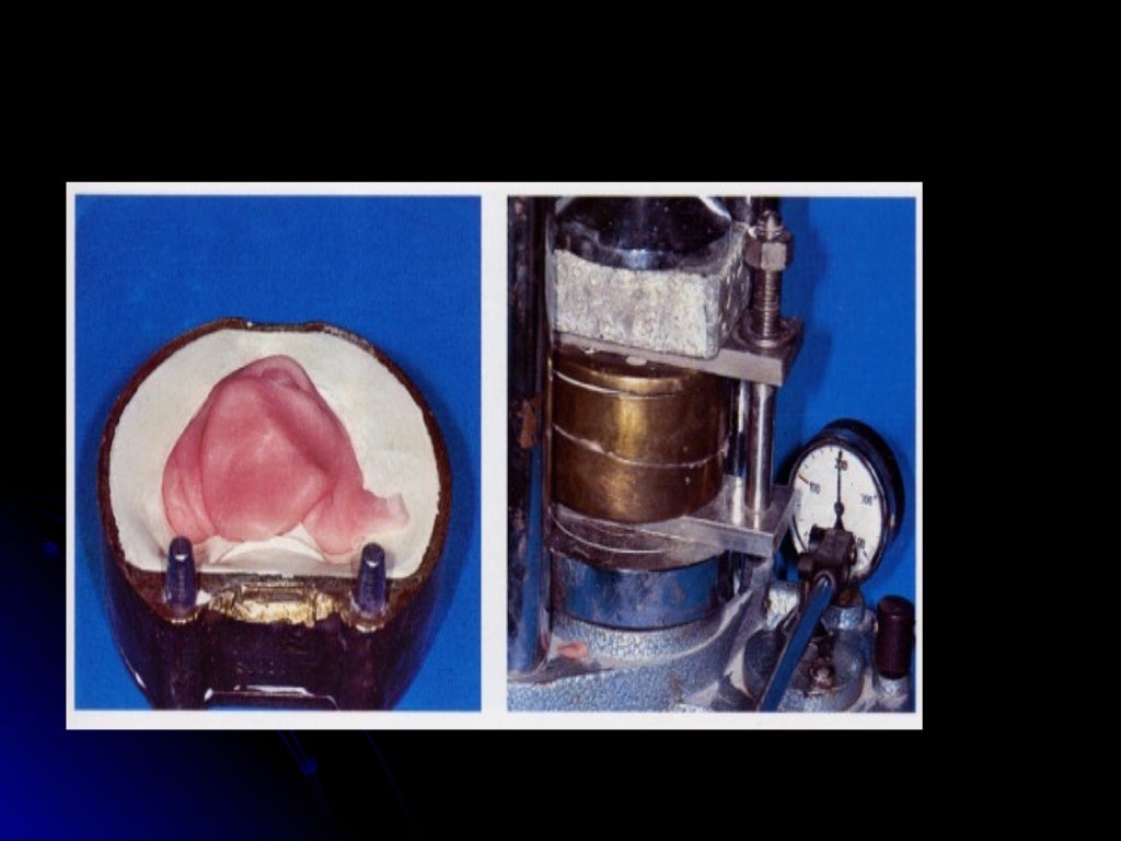 03 01 01_45(flasking and processing complete denture)