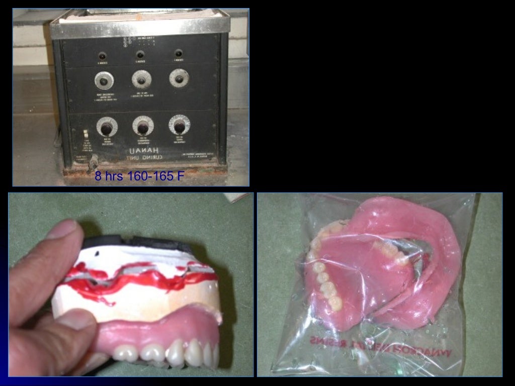 03 01 01_45(flasking and processing complete denture)