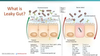 What is
Leaky Gut?
DOI:10.1038/ni.2611 @DrBonnie360
 