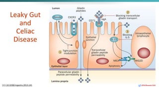 Leaky Gut
and
Celiac
Disease
DOI:10.1038/nrgastro.2013.141 @DrBonnie360
 