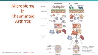 Microbiome
in
Rheumatoid
Arthritis
DOI:10.1038/nrrheum.2011.121 @DrBonnie360
 