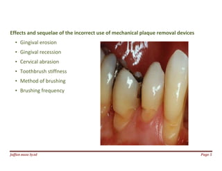 Jаffaя яaza Syзd Page 5
Effects and sequelae of the incorrect use of mechanical plaque removal devices
• Gingival erosion
• Gingival recession
• Cervical abrasion
• Toothbrush stiffness
• Method of brushing
• Brushing frequency
 