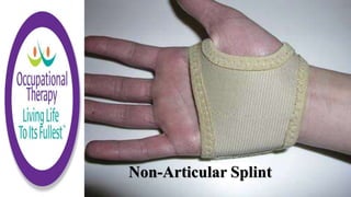 Non-Articular Splint
 