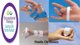 Static Orthoses
 