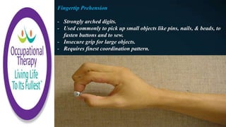 Fingertip Prehension
- Strongly arched digits.
- Used commonly to pick up small objects like pins, nails, & beads, to
fasten buttons and to sew.
- Insecure grip for large objects.
- Requires finest coordination pattern.
 