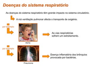 Doenças do sistema respiratório
As doenças do sistema respiratório têm grande impacto no sistema circulatório.
A má ventilação pulmonar afecta o transporte de oxigénio.
por exemplo
As vias respiratórias
sofrem um estreitamento.
Doença inflamatória dos brônquios
provocada por bactérias.
Pneumonia
Asma
por exemplo
 