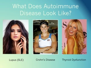 What Does Autoimmune Disease
Look Like?
Crohn’s DiseaseLupus (SLE) Thyroid Dysfunction
 