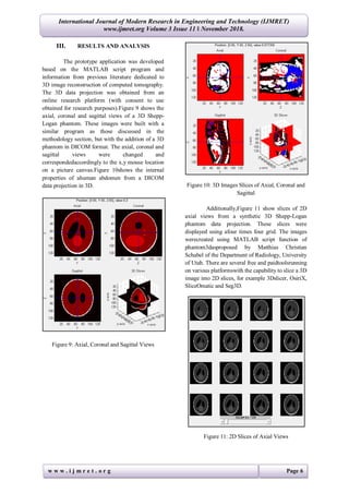 w w w . i j m r e t . o r g Page 6
International Journal of Modern Research in Engineering and Technology (IJMRET)
www.ijmret.org Volume 3 Issue 11 ǁ November 2018.
III. RESULTS AND ANALYSIS
The prototype application was developed
based on the MATLAB script program and
information from previous literature dedicated to
3D image reconstruction of computed tomography.
The 3D data projection was obtained from an
online research platform (with consent to use
obtained for research purposes).Figure 9 shows the
axial, coronal and sagittal views of a 3D Shepp-
Logan phantom. These images were built with a
similar program as those discussed in the
methodology section, but with the addition of a 3D
phantom in DICOM format. The axial, coronal and
sagittal views were changed and
correspondedaccordingly to the x,y mouse location
on a picture canvas.Figure 10shows the internal
properties of ahuman abdomen from a DICOM
data projection in 3D.
Figure 9: Axial, Coronal and Sagittal Views
Figure 10: 3D Images Slices of Axial, Coronal and
Sagittal
Additionally,Figure 11 show slices of 2D
axial views from a synthetic 3D Shepp-Logan
phantom data projection. These slices were
displayed using afour times four grid. The images
werecreated using MATLAB script function of
phantom3dasproposed by Matthias Christian
Schabel of the Department of Radiology, University
of Utah. There are several free and paidtoolsrunning
on various platformswith the capability to slice a 3D
image into 2D slices, for example 3Dslicer, OsiriX,
SliceOmatic and Seg3D.
Figure 11: 2D Slices of Axial Views
 