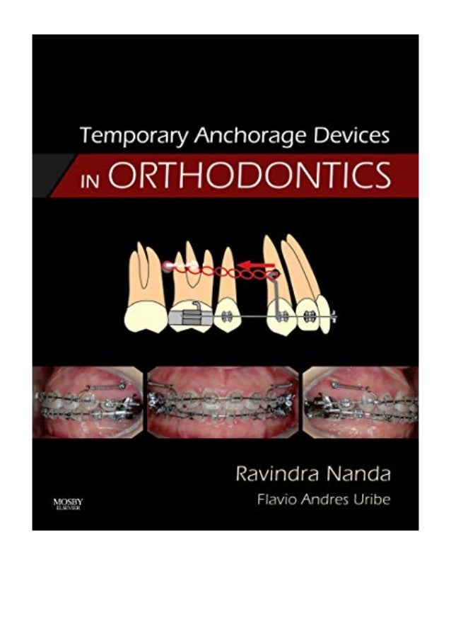 (2008) Temporary Anchorage Devices in Orthodontics (PDF) by Ravindra