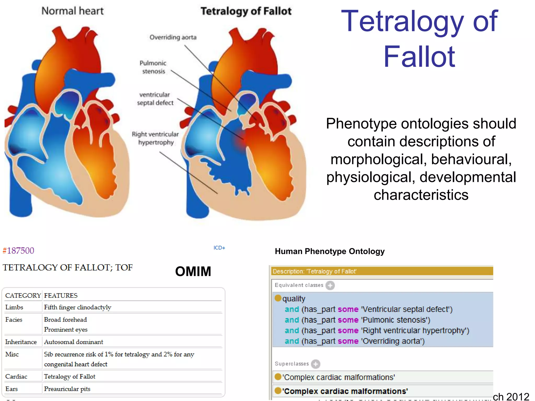 Tetralogy of
                             Fallot

                       Phenotype ontologies should
                          contain descriptions of
                        morphological, behavioural,
                       physiological, developmental
                              characteristics


            Human Phenotype Ontology

     OMIM




39                   Protege Short Course::Dumontier:March 2012
 