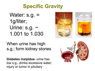 Water: s.g. =
1g/liter;
Urine: s.g. ~
1.001 to 1.030
Specific Gravity
When urine has high
s.g.; form kidney stones
Diabetes insipidus- urine has
low s.g.; drinks excessive water;
injury or tumor in pituitary
 