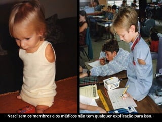 Nasci sem os membros e os médicos não tem qualquer explicação para isso.

 