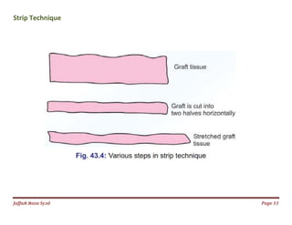 Jаffaя яaza Syзd
Strip Technique
Page 11
 