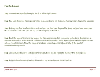 Jаffaя яaza Syзd Page 33
First Technique
Step 1 : Make two apically-divergent vertical releasing incisions
Step 2 : A split thickness flap is prepared on coronal side and full thickness flap is prepared apical to recession
Step 3 : Once the flap is reflected the root surfaces are debrided thoroughly. Some authors have suggested
the use of citric acid with a pH 1.0 for conditioning the root surface.
Step 4 : At the base of the inner surface of the flap, approximately 3 mm apical to the bone dehiscense, a
horizontal incision is made through the periosteum, followed by a blunt dissection into the lining mucosa to
release muscle tension. Now the mucosal graft can be easily positioned coronally at the level of
cementoenamel junction.
Step 5 : interrupted sutures and additional sling sutures can be placed to maintain the flap in place.
Step 6 : Periodontal dressing is placed to protect the wound during initial healing.
 
