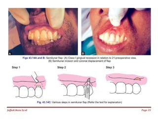 Jаffaя яaza Syзd Page 35
 