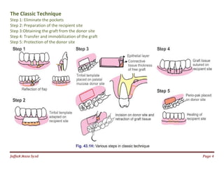 Jаffaя яaza Syзd
The Classic Technique
Step 1: Eliminate the pockets
Step 2: Preparation of the recipient site
Step 3:Obtaining the graft from the donor site
Step 4: Transfer and immobilization of the graft
Step 5: Protection of the donor site
Step 3:Obtaining the graft from the donor site
Step 4: Transfer and immobilization of the graft
Page 4
 