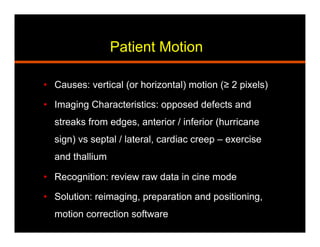 Patient Motion
•  Causes: vertical (or horizontal) motion (≥ 2 pixels)
•  Imaging Characteristics: opposed defects and
streaks from edges, anterior / inferior (hurricane
sign) vs septal / lateral, cardiac creep – exercise
and thallium
•  Recognition: review raw data in cine mode
•  Solution: reimaging, preparation and positioning,
motion correction software
 