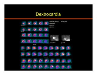 Dextroxardia
 