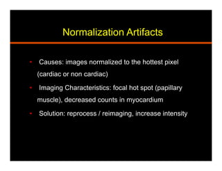 Normalization Artifacts
•  Causes: images normalized to the hottest pixel
(cardiac or non cardiac)
•  Imaging Characteristics: focal hot spot (papillary
muscle), decreased counts in myocardium
•  Solution: reprocess / reimaging, increase intensity
 