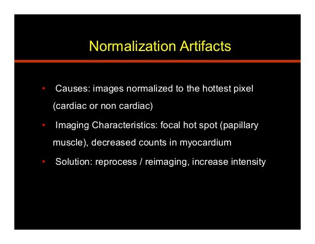 artifact meaning in cardiology