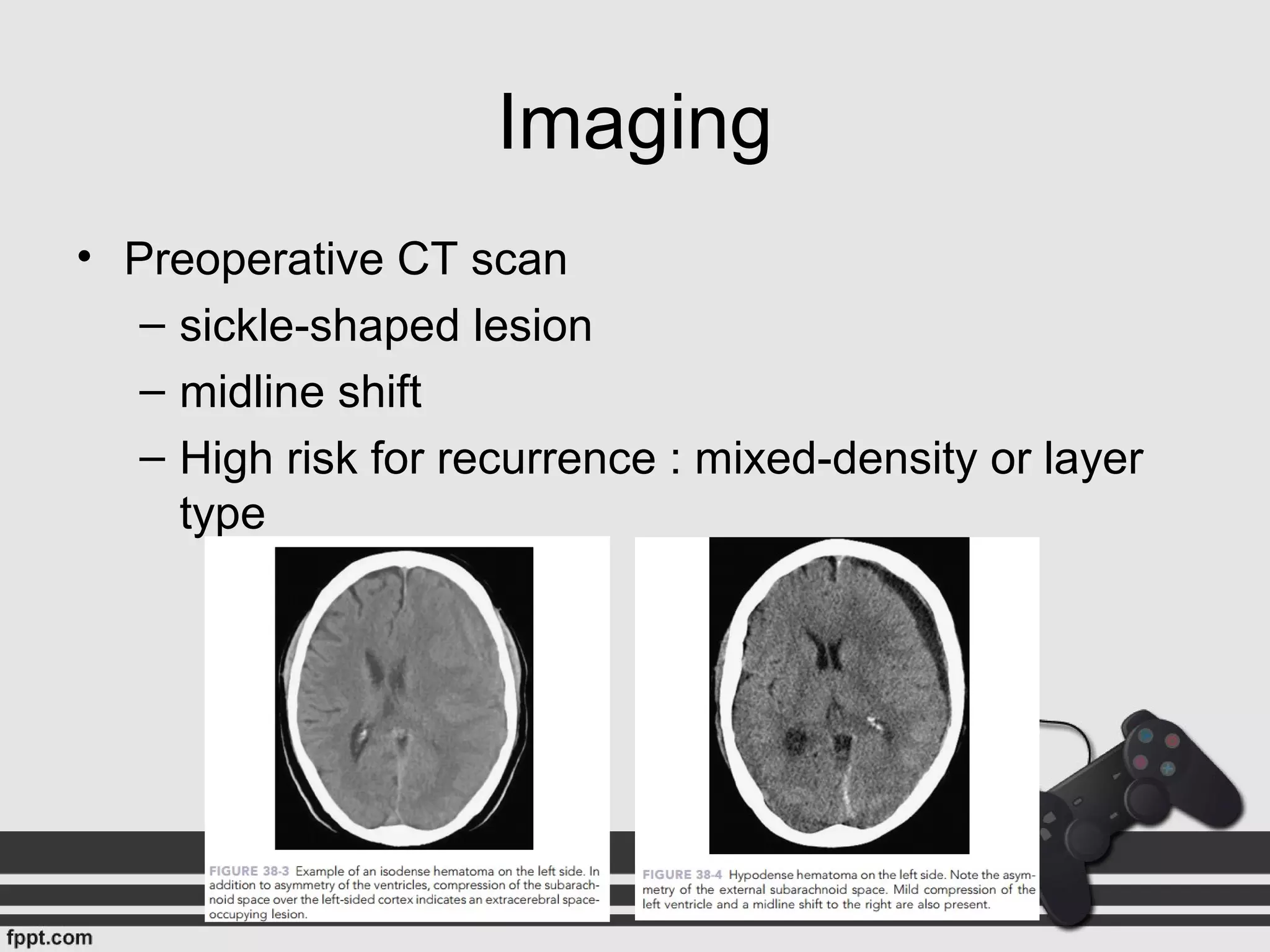 Imaging
• Preoperative CT scan
– sickle-shaped lesion
– midline shift
– High risk for recurrence : mixed-density or layer
type
 