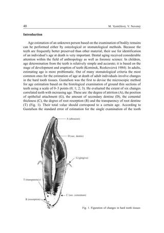 40 M. Vystrèilová, V. Novotný
A (abrasion)
G (gingiva)
D (sec. dentin)
C (sec. cementum)
R (resorption)
T (transparency)
Introduction
Age estimation of an unknown person based on the examination of bodily remains
can be performed either by osteological or stomatological methods. Because the
teeth are frequently better preserved than other material, their use for identification
of an individual’s age at death is very important. Dental aging received considerable
attention within the field of anthropology as well as forensic science. In children,
age determination from the teeth is relatively simple and accurate; it is based on the
stage of development and eruption of teeth (Komínek, Rozkovcová 1984). In adults,
estimating age is more problematic. Out of many stomatological criteria the most
common ones for the estimation of age at death of adult individuals involve changes
in the hard tooth tissues. Gustafson was the first to devise the microscopic method
for age estimation based on the histological examination of ground thin sections of
teeth using a scale of 0–3 points (0; 1; 2; 3). He evalueted the extent of six changes
correlated teeth with increasing age. These are: the degree of attrition (A), the position
of epithelial attachment (G), the amount of secondary dentine (D), the cemental
thickness (C), the degree of root resorption (R) and the transparency of root dentine
(T) (Fig. 1). Their total value should correspond to a certain age. According to
Gustafson the standard error of estimation for the single examination of the tooth
Fig. 1. Figuration of changes in hard tooth tissues
 