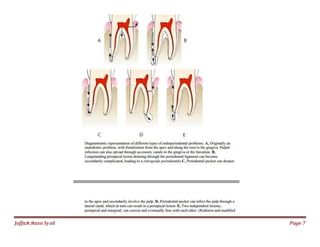 038. endo perio lesions | PDF