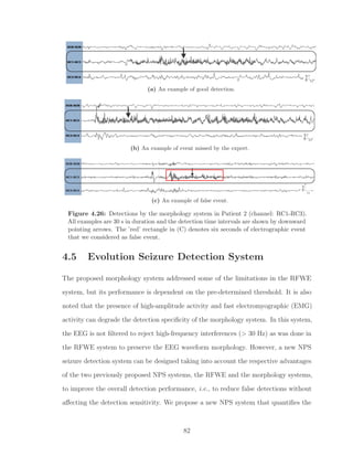 (a) An example of good detection.
(b) An example of event missed by the expert.
(c) An example of false event.
Figure 4.26: Detections by the morphology system in Patient 2 (channel: RC1-RC3).
All examples are 30 s in duration and the detection time intervals are shown by downward
pointing arrows. The ’red’ rectangle in (C) denotes six seconds of electrographic event
that we considered as false event.
4.5 Evolution Seizure Detection System
The proposed morphology system addressed some of the limitations in the RFWE
system, but its performance is dependent on the pre-determined threshold. It is also
noted that the presence of high-amplitude activity and fast electromyographic (EMG)
activity can degrade the detection speciﬁcity of the morphology system. In this system,
the EEG is not ﬁltered to reject high-frequency interferences (> 30 Hz) as was done in
the RFWE system to preserve the EEG waveform morphology. However, a new NPS
seizure detection system can be designed taking into account the respective advantages
of the two previously proposed NPS systems, the RFWE and the morphology systems,
to improve the overall detection performance, i.e., to reduce false detections without
aﬀecting the detection sensitivity. We propose a new NPS system that quantiﬁes the
82
 