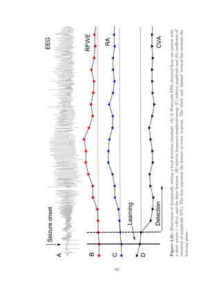 C
D
A
Learning
Detection
Seizureonset
B
CVA
RA
RFWE
EEG
Figure4.31:Illustrationofdynamicallysettingalocaldetectionthreshold.(A)A30-secondsEEGobtainedfromonepatientwith
ashortseizure(∼40s),andthethreefeatures:(B)relativefrequency-weighted-energy(C)relativeamplitudeand(D)coeﬃcientof
variationofamplitude(CV).Thedotsrepresentthefeatureateverym-point.The‘thick’and‘dashed’verticallineenclosesthe
learningphase.
92
 
