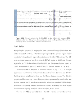 Figure 4.34: Seizure embedded in the 60 s EEG section in Patient 5 (channel: LP1-
LP2) missed by the eSD system, Gotman System and Reveal algorithm. The vertical
downward arrow represents the detection time instances.
Speciﬁcity
Comparing the speciﬁcity of the proposed RFWE and morphology systems with that
of the three NPS systems, both the morphology and eSD systems report similar
speciﬁcity, but signiﬁcantly improved speciﬁcity over the other NPS systems. The eSD
system reports improved speciﬁcity over the RFWE system by 12.9%, the Gotman
system by 16.4%, the Reveal algorithm by 59.9% and the Grewal-Gotman system by
30.6%. Comparison of speciﬁcity with all the NPS systems is shown in Fig. 4.36.
An example of false detection in Patient 1 is shown in Fig. 4.37. The example
represents a false detection due to a burst of sharp transients. The event was detected
by the proposed morphology system, and the Grewal-Gotman system. The detected
event resembles some true events. However, this event cannot be considered a true
seizure, because it does not evolve in a manner similar to that of the EEGer-scored
seizures in this patient. EEGers may ﬁnd such events interesting and often require
consensus from a group of experts before classifying it as a seizure.
The two new NPS systems of Section 4.3 and 4.4 detected several false events in
99
 