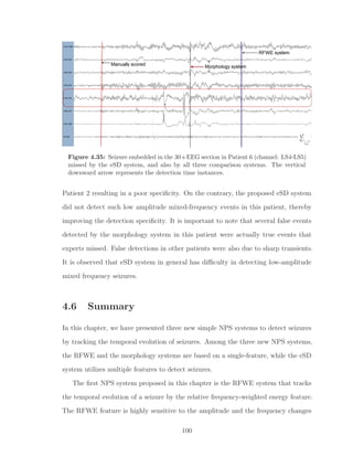 Figure 4.35: Seizure embedded in the 30 s EEG section in Patient 6 (channel: LS4-LS5)
missed by the eSD system, and also by all three comparison systems. The vertical
downward arrow represents the detection time instances.
Patient 2 resulting in a poor speciﬁcity. On the contrary, the proposed eSD system
did not detect such low amplitude mixed-frequency events in this patient, thereby
improving the detection speciﬁcity. It is important to note that several false events
detected by the morphology system in this patient were actually true events that
experts missed. False detections in other patients were also due to sharp transients.
It is observed that eSD system in general has diﬃculty in detecting low-amplitude
mixed frequency seizures.
4.6 Summary
In this chapter, we have presented three new simple NPS systems to detect seizures
by tracking the temporal evolution of seizures. Among the three new NPS systems,
the RFWE and the morphology systems are based on a single-feature, while the eSD
system utilizes multiple features to detect seizures.
The ﬁrst NPS system proposed in this chapter is the RFWE system that tracks
the temporal evolution of a seizure by the relative frequency-weighted energy feature.
The RFWE feature is highly sensitive to the amplitude and the frequency changes
100
 