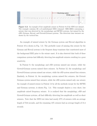 Figure 5.2: An example of low amplitude seizure in Patient 9 of the MNI test dataset.
The example contains 30 s of multichannel EEG (channel: RH1-RH3) containing a
seizure that was detected by the morphology and RFWE systems, but missed by the
eSD, Gotman, Reveal, and Grewal-Gotman systems. The detection time instance are
shown by the vertical line.
An example of missed seizure by the Gotman system and Reveal algorithm in
Patient 10 is shown in Fig. 5.3. The probable cause of missing this seizure by the
Gotman and Reveal systems is the frequent sharp transients that constituted most of
the background EEG prior to the seizure onset. It is also observed that both of these
comparison systems had diﬃculty detecting low-amplitude seizures resulting in a poor
sensitivity.
In Patient 9, the morphology and eSD systems missed one seizure, while the
Grewal-Gotman system missed three seizures. In Patient 12, the morphology and
Grewal-Gotman systems missed one seizure, while the eSD system missed four seizures.
Similarly, in Patient 14, the morphology system missed ﬁve seizures, the Grewal-
Gotman system missed four seizures, while the eSD system missed only one seizure.
An example of missed seizure in Patient 14 by all the methods except for the RFWE
and Gotman systems, is shown Fig. 5.4. This example depicts a very short, low
amplitude mixed frequency seizure. It is realized that the morphology, eSD and
Grewal-Gotman systems, all had diﬃculty detecting low-amplitude as well as short
seizures. Note that the MNI test data had nearly 87% of seizures with an average
length of 72.6 seconds, and the remaining 13% seizures had an average length of 15.4
seconds.
108
 