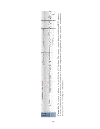 Figure5.3:AnexampleofseizureinPatient10oftheMNIdatabase.Theexamplecontains30sofmultichannelEEG(channel:
RH1-RH2)containingaseizurethatwasdetectedbyallsystemsexcepttheGotmansystemandRevealalgorithm.Thedetection
timeinstancesareshownbytheverticallines.
109
 