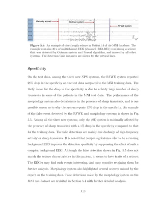 Figure 5.4: An example of short length seizure in Patient 14 of the MNI database. The
example contains 30 s of multichannel EEG (channel: RE3-RE4) containing a seizure
that was detected by Gotman system and Reveal algorithm, and missed by all other
systems. The detection time instances are shown by the vertical lines.
Speciﬁcity
On the test data, among the three new NPS systems, the RFWE system reported
28% drop in the speciﬁcity on the test data compared to the MNI training data. The
likely cause for the drop in the speciﬁcity is due to a fairly large number of sharp
transients in some of the patients in the MNI test data. The performance of the
morphology system also deteriorates in the presence of sharp transients, and is one
possible reason as to why the system reports 13% drop in the speciﬁcity. An example
of the false event detected by the RFWE and morphology systems is shown in Fig.
5.5. Among all the three new systems, only the eSD system is minimally aﬀected by
the presence of sharp transients with a 1% drop in the speciﬁcity compared to that
for the training data. The false detections are mainly due discharge of high-frequency
activity or sharp transients. It is noted that computing features relative to a running
background EEG improves the detection speciﬁcity by suppressing the eﬀect of such a
complex background EEG. Although the false detection shown in Fig. 5.5 does not
match the seizure characteristics in this patient, it seems to have traits of a seizure.
The EEGer may ﬁnd such events interesting, and may consider retaining them for
further analysis. Morphology system also highlighted several seizures missed by the
expert on the training data. False detections made by the morphology system on the
MNI test dataset are revisited in Section 5.4 with further detailed analysis.
110
 