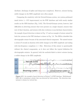 rhythmic, discharge of spikes and sharp-wave complexes). However, seizures having
subtle changes in the EEG amplitude were often missed.
Comparing the sensitivity with the Grewal-Gotman system, our system performed
much better (∼ 15% improvement) on the FSP database and with nearly similar
results on the MNI database (Fig. 5.6A). The Grewal-Gotman system, however, had
diﬃculties in detecting seizures that were present on a single channel, seizures that
were of short duration, and seizures with slow evolution or non-rhythmic characteristics.
An example of good detection is shown in Fig. 5.7 and an example of seizure missed by
both the systems in the FSP database is shown in Fig. 5.8. The EEGer identiﬁed this
electrographic seizure because of the associated clinical component. The missed seizure
is about 27 seconds in duration with subtle changes in the EEG amplitude and ending
with low-frequency complexes (< 1 Hz). Detection of this seizure is questionable
without the clinical components, as it does not follow the typical deﬁnition for
electrographic seizures. In general, both the methods failed to detect seizures having
a subtle change in the EEG amplitude.
Figure 5.7: An example of good detection in Patient 7 of FSP database. Multichannel
EEG (20 s) containing a seizure that was detected by both systems. The detection time
instance is shown by vertical line.
117
 
