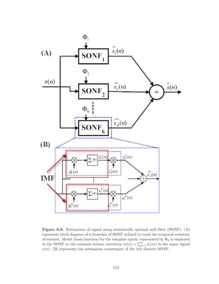 Figure 6.6: Estimation of signal using statistically optimal null ﬁlter (SONF). (A)
represents block diagram of k-branches of SONF utilized to track the temporal evolution
of seizures. Model (basis function) for the template epoch, represented by Φk is employed
in the SONF to the estimate seizure waveform (ˆs(n) = k
i=1 ˆsi(n)) in the input signal
x(n). (B) represents the estimation counterpart of the kth discrete SONF.
152
 