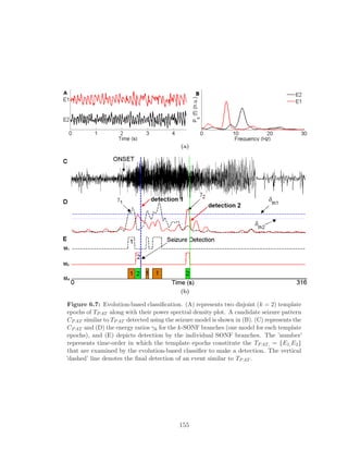 (a)
(b)
Figure 6.7: Evolution-based classiﬁcation. (A) represents two disjoint (k = 2) template
epochs of TPAT along with their power spectral density plot. A candidate seizure pattern
CPAT similar to TPAT detected using the seizure model is shown in (B). (C) represents the
CPAT and (D) the energy ratios γk for the k-SONF branches (one model for each template
epochs), and (E) depicts detection by the individual SONF branches. The ’number’
represents time-order in which the template epochs constitute the TPAT, = {E1,E2}
that are examined by the evolution-based classiﬁer to make a detection. The vertical
’dashed’ line denotes the ﬁnal detection of an event similar to TPAT .
155
 