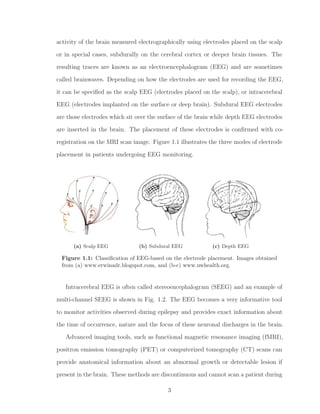 activity of the brain measured electrographically using electrodes placed on the scalp
or in special cases, subdurally on the cerebral cortex or deeper brain tissues. The
resulting traces are known as an electroencephalogram (EEG) and are sometimes
called brainwaves. Depending on how the electrodes are used for recording the EEG,
it can be speciﬁed as the scalp EEG (electrodes placed on the scalp), or intracerebral
EEG (electrodes implanted on the surface or deep brain). Subdural EEG electrodes
are those electrodes which sit over the surface of the brain while depth EEG electrodes
are inserted in the brain. The placement of these electrodes is conﬁrmed with co-
registration on the MRI scan image. Figure 1.1 illustrates the three modes of electrode
placement in patients undergoing EEG monitoring.
(a) Scalp EEG (b) Subdural EEG (c) Depth EEG
Figure 1.1: Classiﬁcation of EEG-based on the electrode placement. Images obtained
from (a) www.erwinadr.blogspot.com, and (b-c) www.uwhealth.org.
Intracerebral EEG is often called stereoencephalogram (SEEG) and an example of
multi-channel SEEG is shown in Fig. 1.2. The EEG becomes a very informative tool
to monitor activities observed during epilepsy and provides exact information about
the time of occurrence, nature and the focus of these neuronal discharges in the brain.
Advanced imaging tools, such as functional magnetic resonance imaging (fMRI),
positron emission tomography (PET) or computerized tomography (CT) scans can
provide anatomical information about an abnormal growth or detectable lesion if
present in the brain. These methods are discontinuous and cannot scan a patient during
3
 