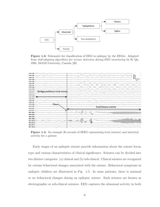 EEG
Normal
Abnormal
Epileptiform
Non-epileptiform
Spikes
Seizure
Figure 1.3: Schematic for classiﬁcation of EEG in epilepsy by the EEGer. Adapted
from Self-adapting algorithms for seizure detection during EEG monitoring by H. Qu,
1995, McGill University, Canada [20].
Figure 1.4: An example 20 seconds of SEEG representing ictal (seizure) and interictal
activity for a patient
Early stages of an epileptic seizure provide information about the seizure focus,
type and various characteristics of clinical signiﬁcance. Seizures can be divided into
two distinct categories: (a) clinical and (b) sub-clinical. Clinical seizures are recognized
by certain behavioral changes associated with the seizure. Behavioral symptoms in
epileptic children are illustrated in Fig. 1.5. In some patients, there is minimal
or no behavioral changes during an epileptic seizure. Such seizures are known as
electrographic or sub-clinical seizures. EEG captures the abnormal activity in both
6
 
