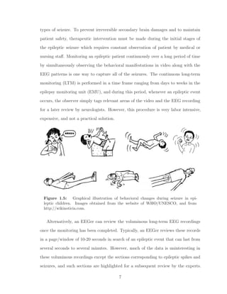 types of seizure. To prevent irreversible secondary brain damages and to maintain
patient safety, therapeutic intervention must be made during the initial stages of
the epileptic seizure which requires constant observation of patient by medical or
nursing staﬀ. Monitoring an epileptic patient continuously over a long period of time
by simultaneously observing the behavioral manifestations in video along with the
EEG patterns is one way to capture all of the seizures. The continuous long-term
monitoring (LTM) is performed in a time frame ranging from days to weeks in the
epilepsy monitoring unit (EMU), and during this period, whenever an epileptic event
occurs, the observer simply tags relevant areas of the video and the EEG recording
for a later review by neurologists. However, this procedure is very labor intensive,
expensive, and not a practical solution.
Figure 1.5: Graphical illustration of behavioral changes during seizure in epi-
leptic children. Images obtained from the website of WHO/UNESCO, and from
http://wikinoticia.com.
Alternatively, an EEGer can review the voluminous long-term EEG recordings
once the monitoring has been completed. Typically, an EEGer reviews these records
in a page/window of 10-20 seconds in search of an epileptic event that can last from
several seconds to several minutes. However, much of the data is uninteresting in
these voluminous recordings except the sections corresponding to epileptic spikes and
seizures, and such sections are highlighted for a subsequent review by the experts.
7
 