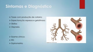 Sintomas e Diagnóstico
⮚ Tosse com produção de catarro;
⮚ Expectoração espessa e gelatinosa;
⮚ Sibilos;
⮚ Dispneia.
⮚ Exame clínico;
⮚ RX;
⮚ Espirometria.
 