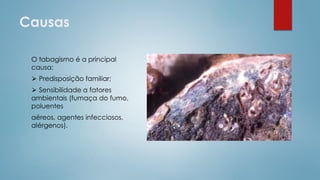 Causas
O tabagismo é a principal
causa;
⮚ Predisposição familiar;
⮚ Sensibilidade a fatores
ambientais (fumaça do fumo,
poluentes
aéreos, agentes infecciosos,
alérgenos).
 