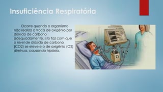 Insuficiência Respiratória
Ocorre quando o organismo
não realiza a troca de oxigênio por
dióxido de carbono
adequadamente, isto faz com que
o nível de dióxido de carbono
(CO2) se eleve e o de oxigênio (O2)
diminua, causando hipóxia.
 