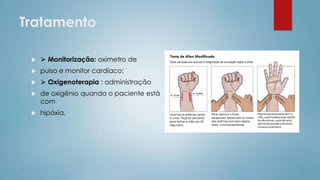 Tratamento
 ⮚ Monitorização: oxímetro de
 pulso e monitor cardíaco;
 ⮚ Oxigenoterapia : administração
 de oxigênio quando o paciente está
com
 hipóxia.
 
