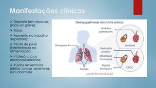 Manifestações clínicas
⮚ Dispneia (em repouso,
pode ser grave);
⮚ Tosse;
⮚ Aumento no trabalho
respiratório;
⮚ Perda de peso
(interferência na
alimentação);
⮚ Intolerância os
esforços/exercícios;
⮚ Ruídos Adventícios
(sibilos, roncos, estertores:
sons anormais
 