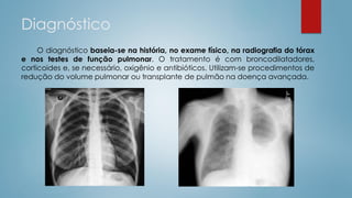 Diagnóstico
O diagnóstico baseia-se na história, no exame físico, na radiografia do tórax
e nos testes de função pulmonar. O tratamento é com broncodilatadores,
corticoides e, se necessário, oxigênio e antibióticos. Utilizam-se procedimentos de
redução do volume pulmonar ou transplante de pulmão na doença avançada.
 