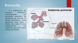 Bronquite
É a inflamação da
mucosa brônquica,
caracterizada por
produção excessiva de
secreção da mucosa na
árvore brônquica. Tosse
produtiva que dura 3
meses em cada 2 anos
consecutivos, em
paciente que tem outras
causas excluídas.
 