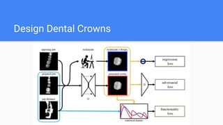 Design Dental Crowns
 