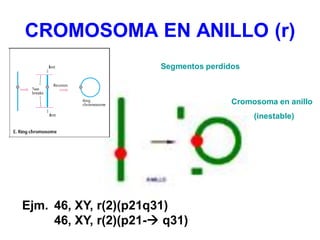CROMOSOMA EN ANILLO (r)
Ejm. 46, XY, r(2)(p21q31)
46, XY, r(2)(p21- q31)
Cromosoma en anillo
(inestable)
Segmentos perdid...